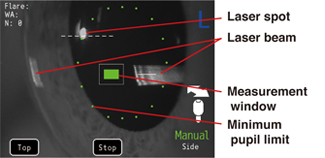 Side view alignment