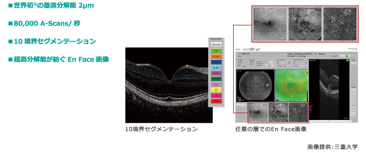 Bi M Oct 眼底カメラ 製品情報 コーワ 医療関連機器 Bi M Oct 眼底カメラ 製品情報 コーワ 医療関連機器