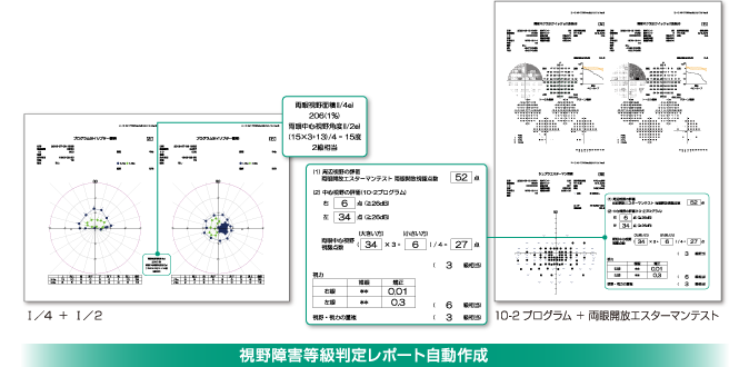 視覚障害等級判定レポート自動作成の画像