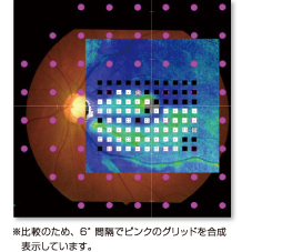 >眼底・OCT対応視野検査の画像