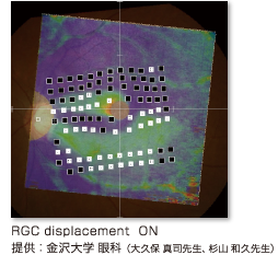 RGC displacementの画像